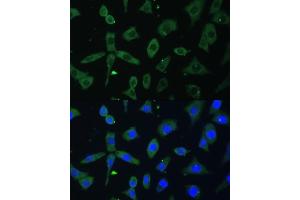 Immunofluorescence analysis of L-929 cells using EIF3D antibody (ABIN6130833, ABIN6140057, ABIN6140058 and ABIN6221638) at dilution of 1:100. (EIF3D Antikörper  (AA 1-240))