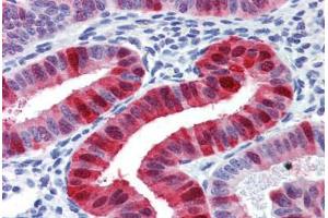 Uterus, Human: Formalin-Fixed, Paraffin-Embedded (FFPE) (Metallothionein Antikörper)