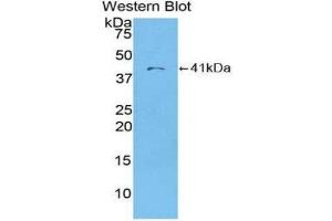 Western Blotting (WB) image for anti-Chemokine (C-C Motif) Ligand 22 (CCL22) (AA 25-93) antibody (ABIN1859795)