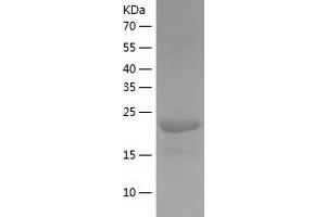 Western Blotting (WB) image for TGFB-Induced Factor Homeobox 2-Like, X-Linked (TGIF2LX) (AA 1-241) protein (His tag) (ABIN7125348) (TGIF2LX Protein (AA 1-241) (His tag))
