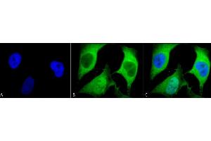 Immunocytochemistry/Immunofluorescence analysis using Mouse Anti-Ubiquitin Monoclonal Antibody, Clone 5B9-B3 (ABIN361810 and ABIN361811). (Ubiquitin Antikörper)