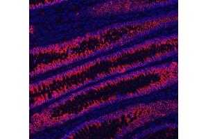 IF analysis of LI Cadherin/CDH17 using anti-LI Cadherin/CDH17 antibody (ABIN7600855).