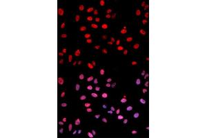 Immunofluorescence analysis of U2OS cells using Phospho-Jun-S243 antibody (ABIN5969907). (C-JUN Antikörper  (pSer243))