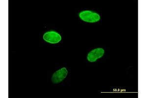 Immunofluorescence of purified MaxPab antibody to LBR on HeLa cell.