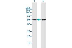 Western Blot analysis of TUBB4Q expression in transfected 293T cell line by TUBB4Q MaxPab polyclonal antibody. (TUBB7P Antikörper  (AA 1-434))