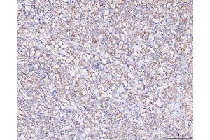 IHC analysis of ATX2/ATXN2 using anti-ATX2/ATXN2 antibody (ABIN3043507). (Ataxin 2 Antikörper  (C-Term))