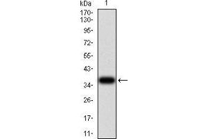 Western blot analysis using ACVR1 mAb against human ACVR1 (AA: 21-120) recombinant protein.
