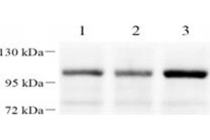 Western blot analysis of FOXK1 (ABIN7073970) at dilution of 1: 1000,Lane 1: HeLa cell lysate,Lane 2: 293T cell lysate,Lane 3: H1299 cell lysate (Foxk1 Antikörper)