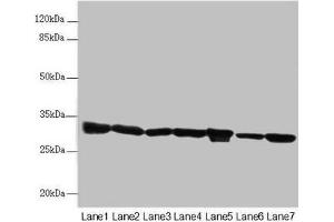 Western blot All lanes: ECHS1 antibody at 3. (ECHS1 Antikörper  (AA 28-290))