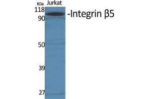 Western Blot (WB) analysis of specific cells using Integrin beta5 Polyclonal Antibody. (Integrin beta 5 Antikörper  (C-Term))
