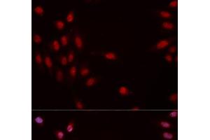 Immunofluorescence analysis of MCF-7 cells using Phospho-CHEK1(S317) Polyclonal Antibody (CHEK1 Antikörper  (pSer317))