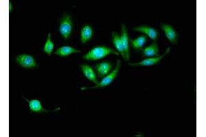 Immunofluorescence staining of A549 cells with ABIN7142296 at 1:133, counter-stained with DAPI. (HSD17B1 Antikörper  (AA 2-261))