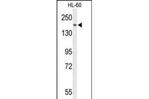 Western blot analysis of PLCB1 Antibody (C-term) (ABIN653321 and ABIN2842813) in HL-60 cell line lysates (35 μg/lane). (Phospholipase C beta 1 Antikörper  (C-Term))