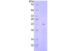 SDS-PAGE analysis of Human EGR1 Protein. (EGR1 Protein)