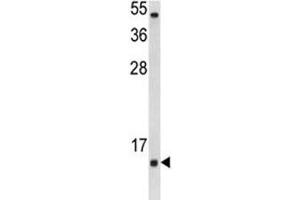 Western blot analysis of SOD1 antibody and Jurkat lysate. (SOD1 Antikörper  (AA 55-84))