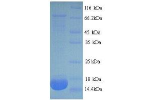 phospholipase A2, Group IIA (Platelets, Synovial Fluid) (PLA2G2A) (AA 22-146), (full length) protein (His tag) (PLA2G2A Protein (AA 22-146, full length) (His tag))