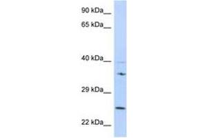 Image no. 1 for anti-Growth Factor Receptor-Bound Protein 2 (GRB2) (N-Term) antibody (ABIN6747987) (GRB2 Antikörper  (N-Term))