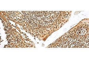Immunohistochemistry of paraffin-embedded Human tonsil tissue using GRSF1 Polyclonal Antibody at dilution of 1:30(x200) (GRSF1 Antikörper)