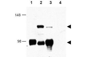 Image no. 1 for anti-CREB Regulated Transcription Coactivator 1 (CRTC1) (AA 19-34) antibody (ABIN401346) (CRTC1 Antikörper  (AA 19-34))