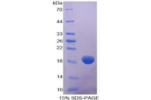 SDS-PAGE analysis of Human COL8A2 Protein.