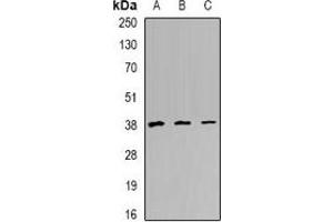 Western blot analysis of TREX1 expression in Hela (A), Raji (B), mouse heart (C) whole cell lysates.