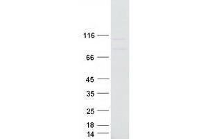 MOV10 Protein (Transcript Variant 1) (Myc-DYKDDDDK Tag)