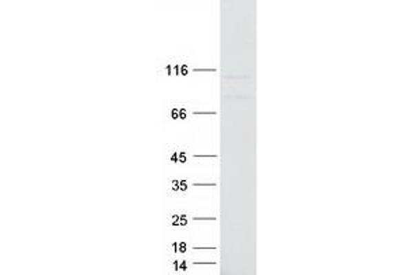 MOV10 Protein (Transcript Variant 1) (Myc-DYKDDDDK Tag)