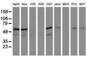 Image no. 1 for anti-Katanin P60 Subunit A-Like 1 (KATNAL1) antibody (ABIN1498985) (KATNAL1 Antikörper)