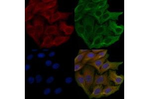 ABIN6259383 and ABIN6276148 staining Hela cells by IF/ICC.