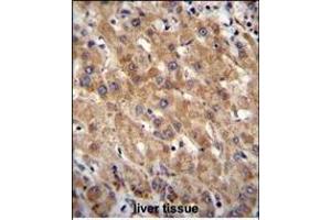 MIA40 Antibody (C-term) (ABIN655475 and ABIN2844998) immunohistochemistry analysis in formalin fixed and paraffin embedded human liver tissue followed by peroxidase conjugation of the secondary antibody and DAB staining. (CHCHD4 Antikörper  (C-Term))