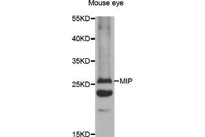 Western blot analysis of extracts of mouse eye, using MIP antibody (ABIN5971491) at 1:400 dilution. (MIP Antikörper)