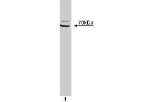 Western blot analysis of ZAP-70 Kinase on a Jurkat cell lysate (Human T-cell leukemia, ATCC TIB-152).