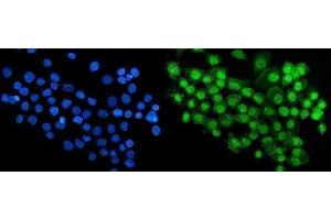 IF analysis of RBM47 using anti-RBM47 antibody (ABIN7602242). (RBM47 Antikörper  (AA 66-317))