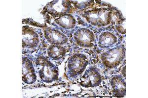IHC analysis of PSMB4 using anti-PSMB4 antibody (ABIN7600532).