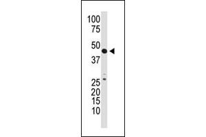 The anti-GDF3 N-term Pab (ABIN388818 and ABIN2839136) is used in Western blot to detect GDF3 in mouse kidney tissue lysate. (GDF3 Antikörper  (N-Term))