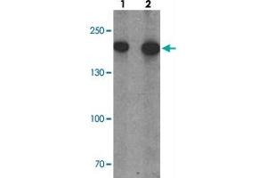 Western blot analysis of PHLPP1 in SW480 cell lysate with PHLPP1 polyclonal antibody  at (1) 1 and (2) 2 ug/mL. (PHLPP1 Antikörper  (N-Term))