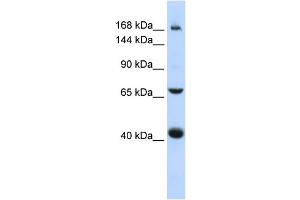 WB Suggested Anti-ABCC9 Antibody Titration:  0. (ABCC9 Antikörper  (Middle Region))