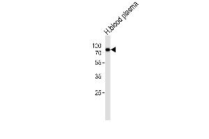 Western blot analysis of lysate from human blood plasma tissue lysate,using THRB Antibody (, Cleaved-Arg327)(ABIN6242006). (THRB Antikörper  (Cleaved-Arg327))