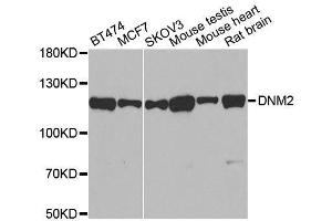 Western blot analysis of extracts of various cell lines, using DNM2 antibody. (DNM2 Antikörper)