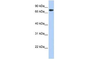 WB Suggested Anti-KLHL23 Antibody Titration: 0. (KLHL23 Antikörper  (Middle Region))