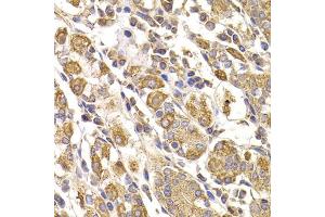 Immunohistochemistry of paraffin-embedded human stomach using METTL7B antibody (ABIN5974333) at dilution of 1/100 (40x lens). (METTL7B Antikörper)