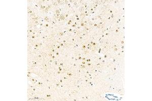 Immunohistochemistry analysis of paraffin embedded mouse brain using KCNIP3 (ABIN7073771) at dilution of 1: 2000 (DREAM Antikörper)