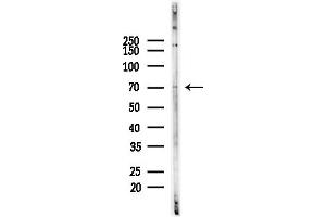 anti-Adducin 3 (Gamma) (ADD3) (Internal Region) antibody