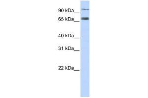 Western Blotting (WB) image for anti-Transporter 1, ATP-Binding Cassette, Sub-Family B (MDR/TAP) (TAP1) (Middle Region) antibody (ABIN2781498)
