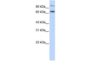 WB Suggested Anti-TAP1 Antibody Titration:  0.