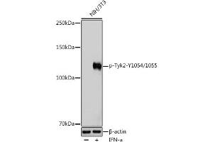 Western blot analysis of extracts of NIH/3T3 cells, using Phospho-Tyk2-Y1054/1055 Rabbit pAb (ABIN6135332, ABIN6136278, ABIN6136279 and ABIN6225571) at 1:1000 dilution. (TYK2 Antikörper  (pTyr1054, pTyr1055))