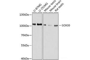 Western blot analysis of extracts of various cell lines using SOX30 Polyclonal Antibody at dilution of 1:1000. (SOX30 Antikörper)