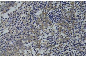 Immunohistochemistry (Paraffin-embedded Sections) (IHC (p)) image for anti-Guanine Nucleotide Binding Protein (G Protein), alpha 15 (Gq Class) (GNA15) antibody (ABIN7009946)