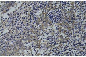 Immunohistochemistry of paraffin-embedded Human tonsil using GNA15 Polyclonal Antibody at dilution of 1:100 (40x lens).