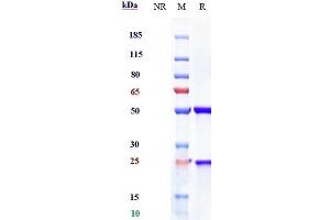 Anti-IL-23a Reference Antibody (risankizumab) on SDS-PAGE under reducing (R) condition. (Rekombinanter IL23A (Risankizumab Biosimilar) Antikörper)